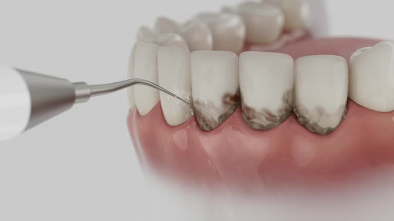 Reliable Dental Implants contractor in Miami, FL by Smile Center Dentistry